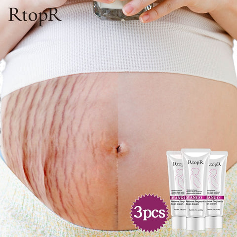 Pregnancy Scars Skin Body Cream Postpartum Stretch